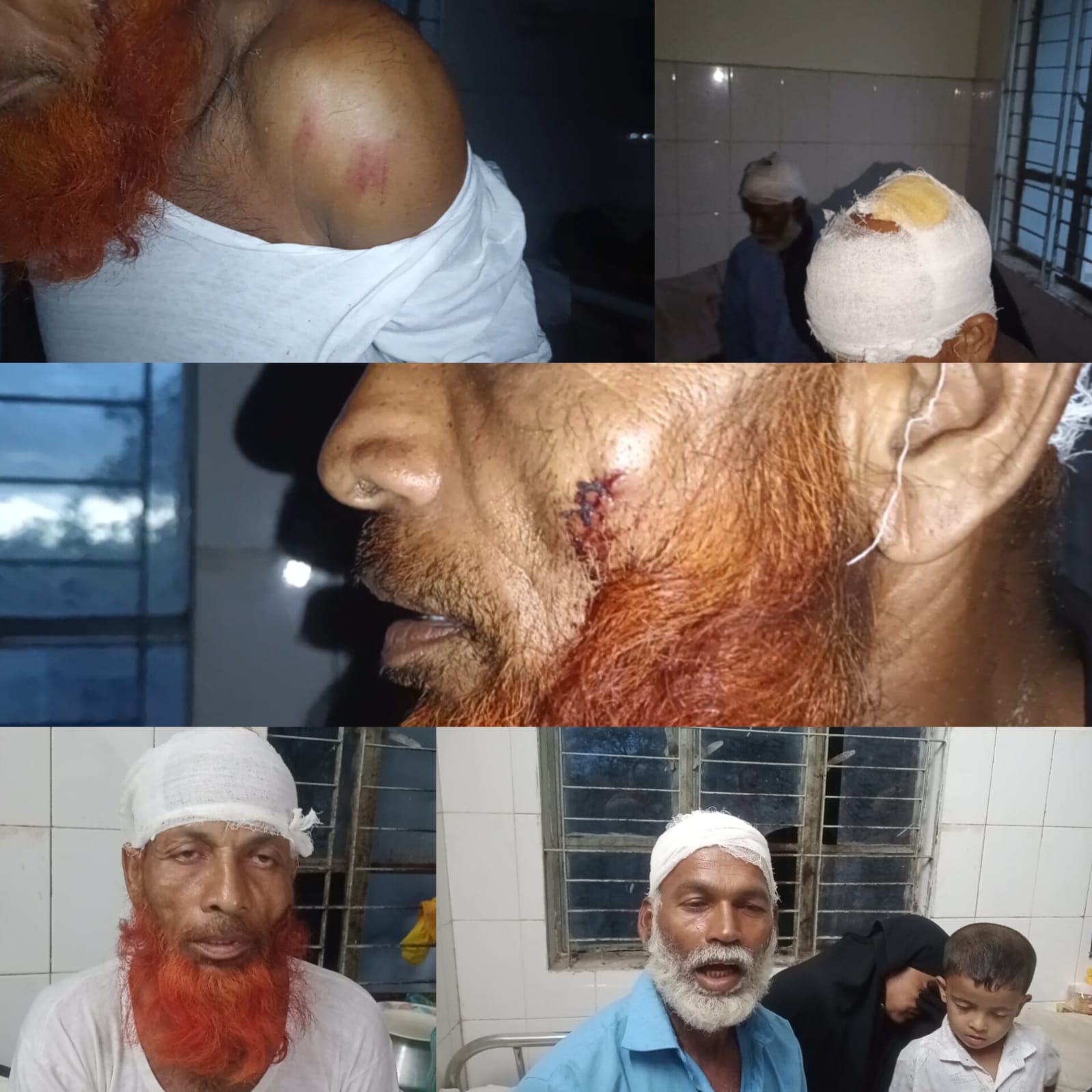মোল্লাহাটে জমির বিরোধকে কেন্দ্র করে সংঘর্ষ, আহত ৩
