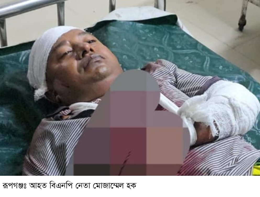 রূপগঞ্জে সালিশ বৈঠকে বিএনপি নেতাকে কুপিয়ে জখম