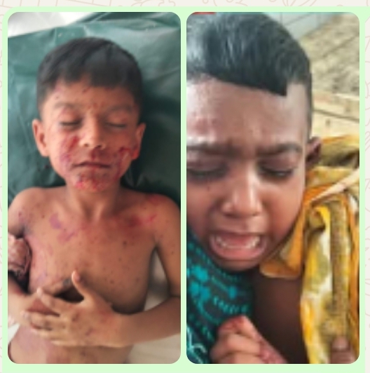 যশোর শহরতলীর ধর্মতলা এলাকায় বোমা সদৃশ বস্তু বিস্ফোরণে দুই শিশু আহত