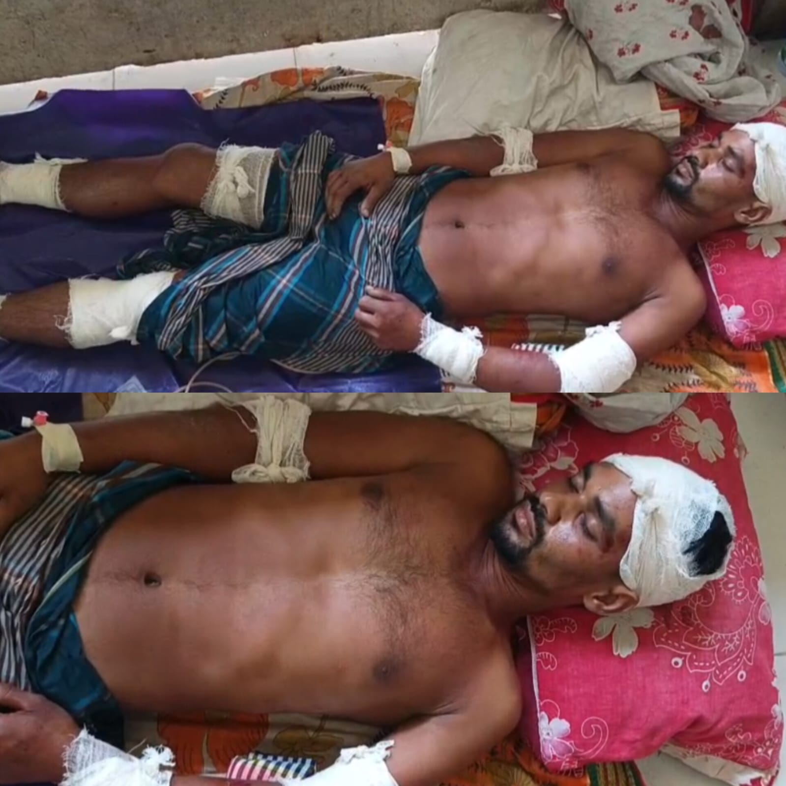 মোল্লাহাটে যুবককে অপহরণ করে কুপিয়ে জখম, আশঙ্কাজনক অবস্থায় হাসপাতালে