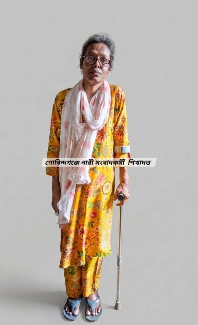 গাইবান্ধার গোবিন্দগঞ্জ উপজেলায় পঙ্গুত্বের সঙ্গে লড়াই করছেন নারী সাংবাদিক শিখাদত্ত প্রয়োজন ১৫ লাখ টাকা