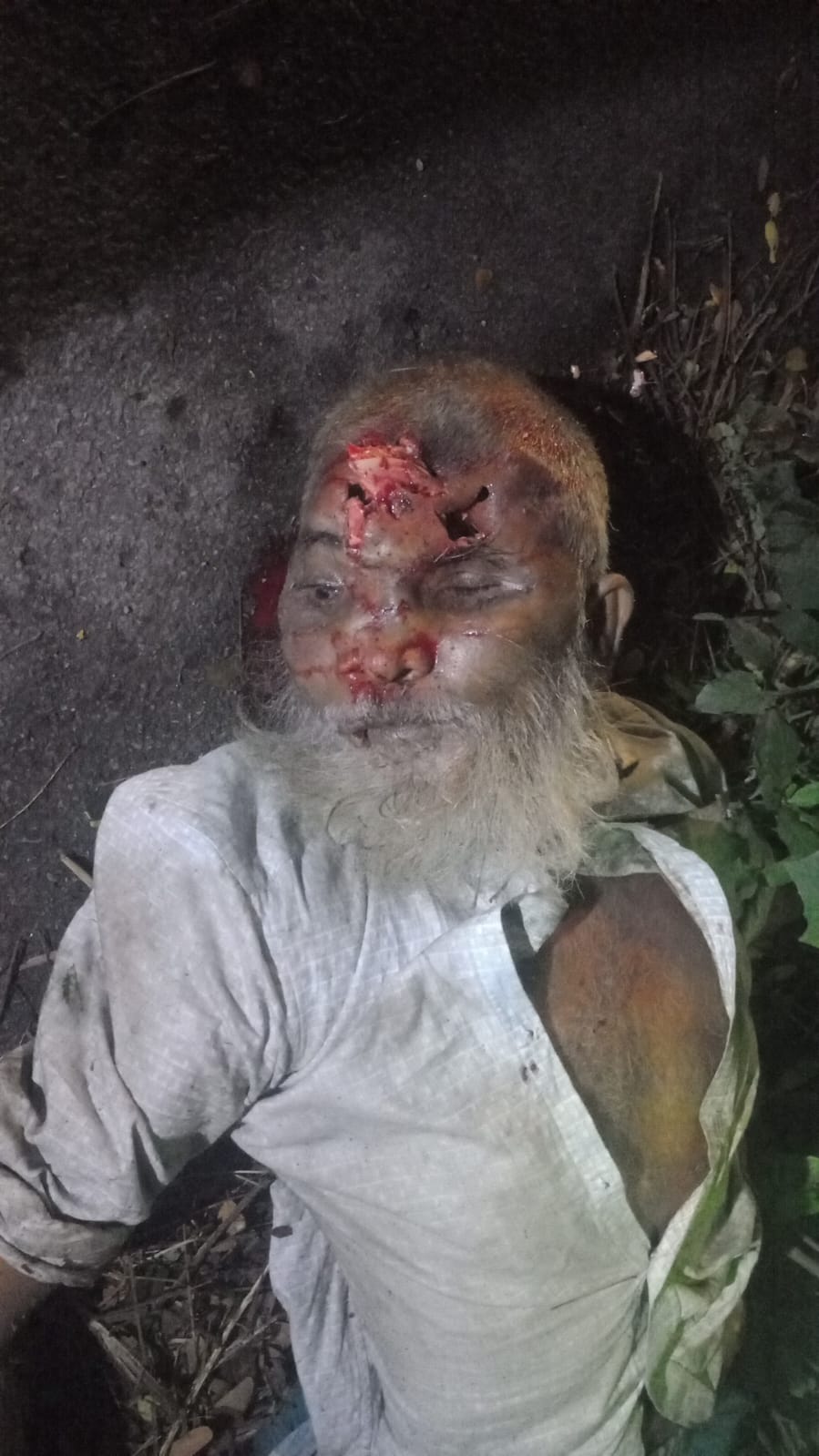 মোল্লাহাট থানাধীন সুরিগাতী গ্রামস্থ সরকারি পুকুরের সামনে ঢাকা খুলনা মহাসড়কের উপরে অদ্য ১৮/০৮/২৬ইং রাত অনুঃ ৮ঃ৪৫ ঘটিকার সময় অজ্ঞাতনামা গাড়ির ধাক্কায় অজ্ঞাত নামা ৭৫ বছর বয়সের বৃদ্ধে মৃত্যু