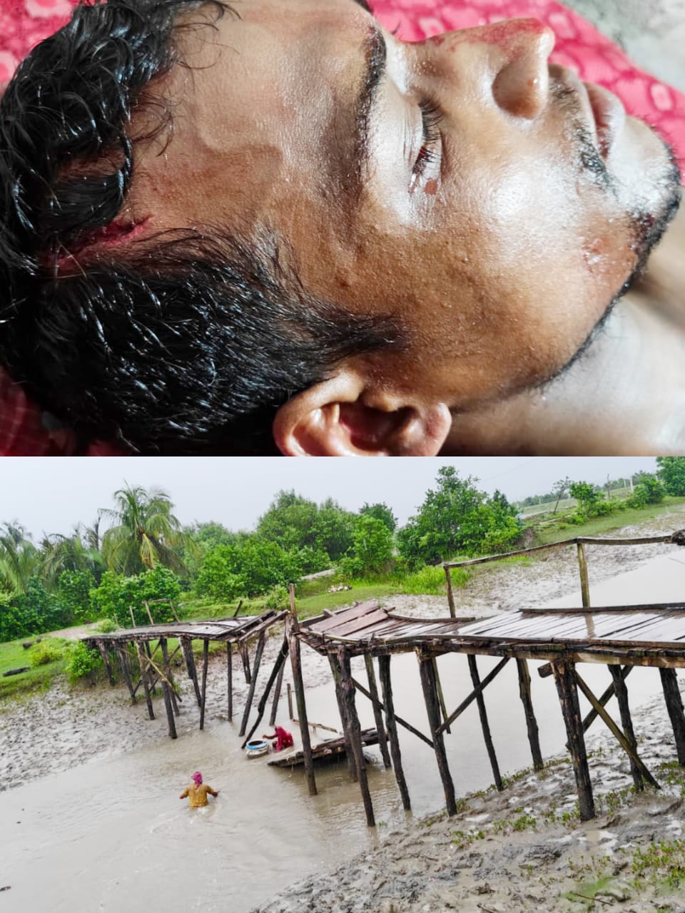 বারবার অভিযোগ, তবুও ব্যবস্থা নয়: অবহেলায় ভেঙে পড়ল কুমারখালী-চাটার্জিখালী সংযোগ পোল, আহত দিনমজুর