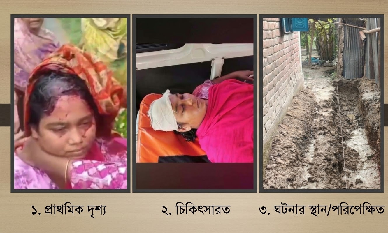 ধামইরহাটে জমি সংক্রান্ত বিরোধে গৃহবধূর মাথা থেঁতলে দেওয়ার অভিযোগ, আশঙ্কাজনক অবস্থায় রাজশাহী মেডিকেলে ভর্তি